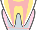 歯茎と歯の根の画像